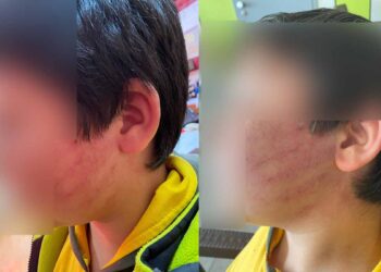 Karatay’da ilkokulda akılalmaz olay: Sıra tartışması sonrası çocukları darp ettiler